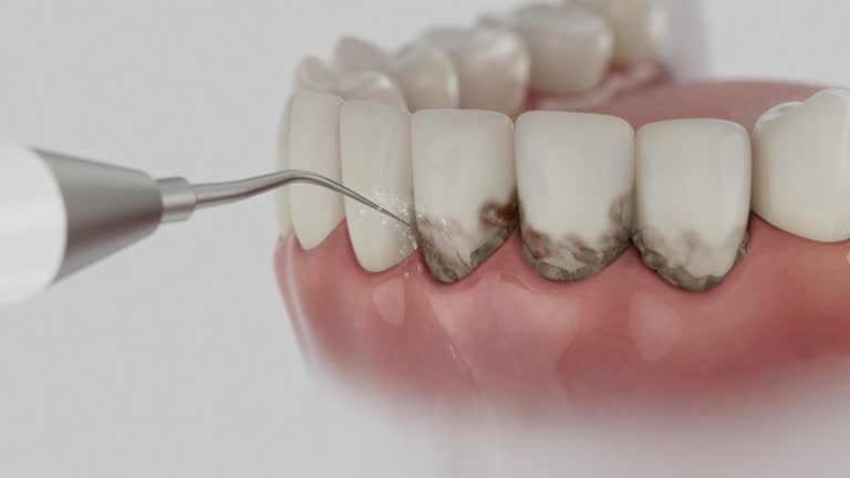 Reliable Dental contractor in Iowa, LA by Dentist Open Now